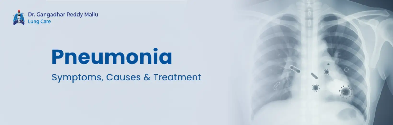 Spine Surgery Myths Spine Surgery Myths